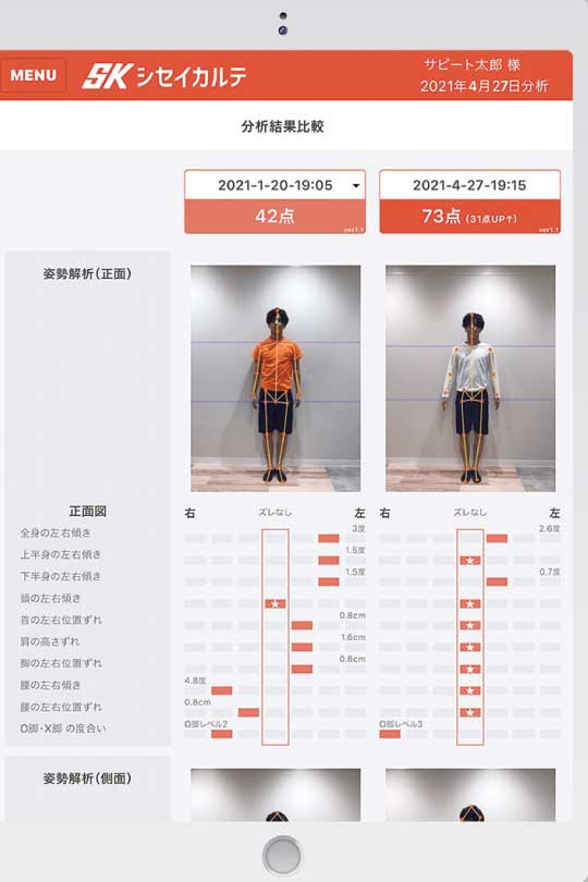 ホップステップサンテ